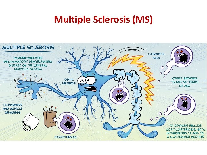 Multiple Sclerosis (MS) 