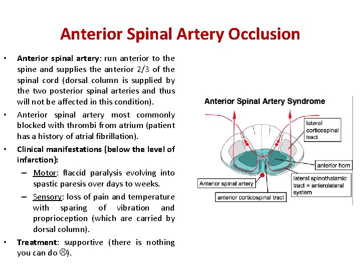 Anterior Spinal Artery Occlusion • • Anterior spinal artery: run anterior to the spine