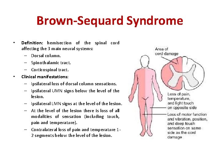 Brown-Sequard Syndrome • • Definition: hemisection of the spinal cord affecting the 3 main