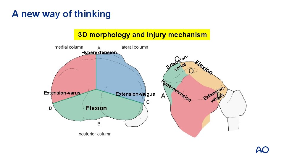 A new way of thinking 3 D morphology and injury mechanism Hyperextension - ion