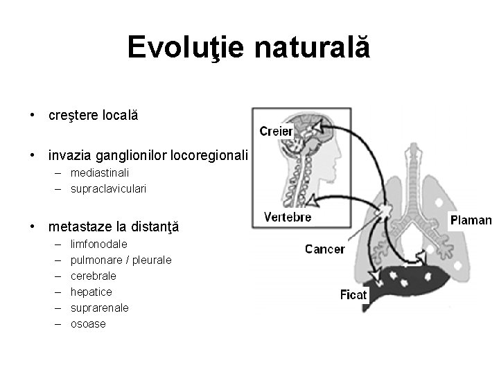 Evoluţie naturală • creştere locală • invazia ganglionilor locoregionali – mediastinali – supraclaviculari •