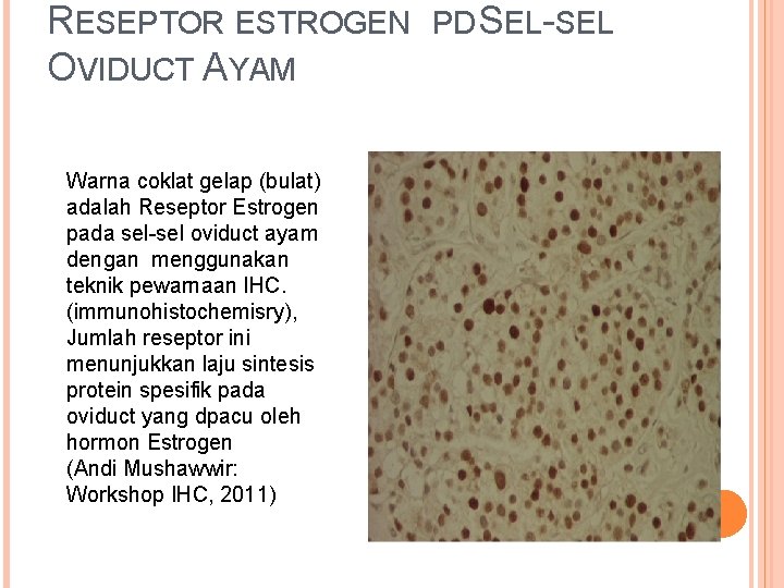RESEPTOR ESTROGEN OVIDUCT AYAM Warna coklat gelap (bulat) adalah Reseptor Estrogen pada sel-sel oviduct