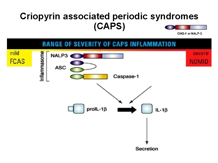 Criopyrin associated periodic syndromes (CAPS) 