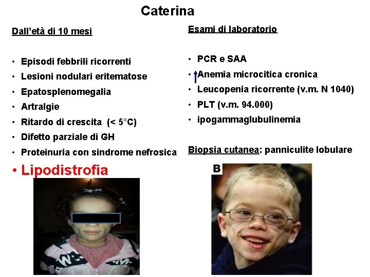 Caterina Dall’età di 10 mesi Esami di laboratorio • Episodi febbrili ricorrenti • PCR