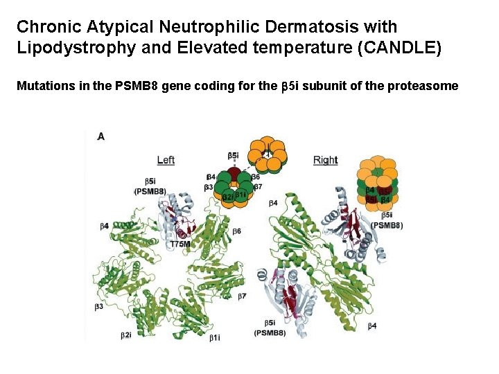 Chronic Atypical Neutrophilic Dermatosis with Lipodystrophy and Elevated temperature (CANDLE) Mutations in the PSMB