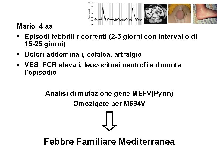 Mario, 4 aa • Episodi febbrili ricorrenti (2 -3 giorni con intervallo di 15