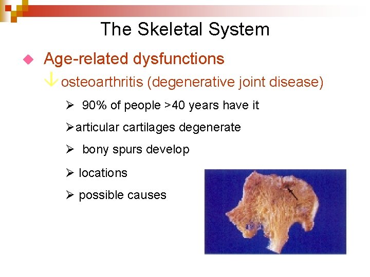 The Skeletal System u Age-related dysfunctions â osteoarthritis (degenerative joint disease) Ø 90% of