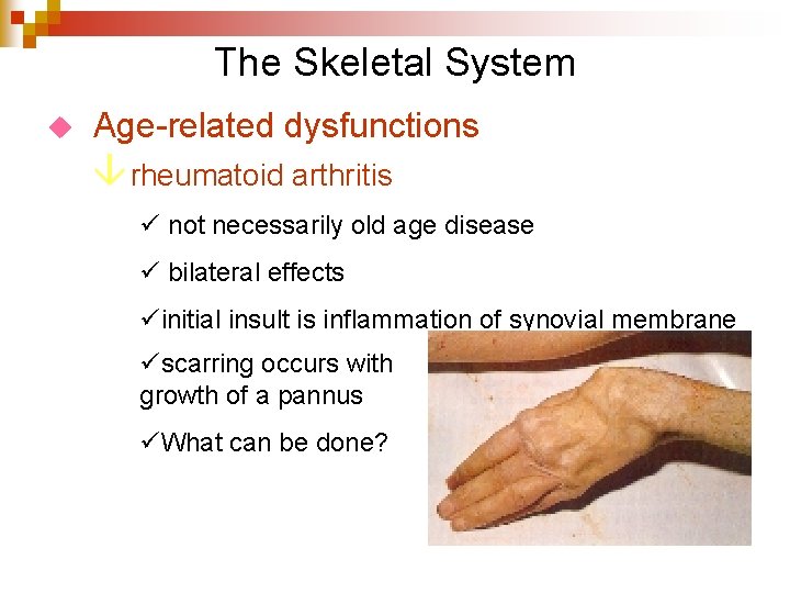 The Skeletal System u Age-related dysfunctions â rheumatoid arthritis ü not necessarily old age