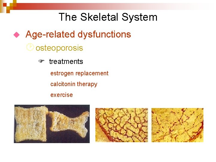 The Skeletal System u Age-related dysfunctions ¸ osteoporosis F treatments estrogen replacement calcitonin therapy