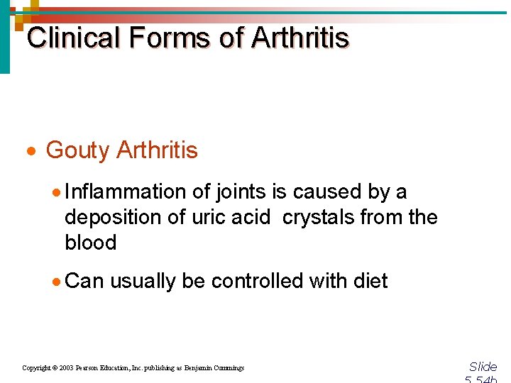 Clinical Forms of Arthritis · Gouty Arthritis · Inflammation of joints is caused by