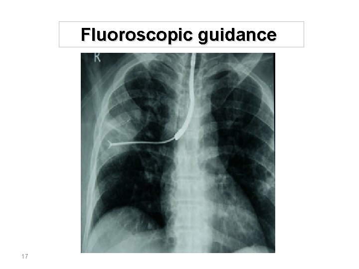 Fluoroscopic guidance 17 