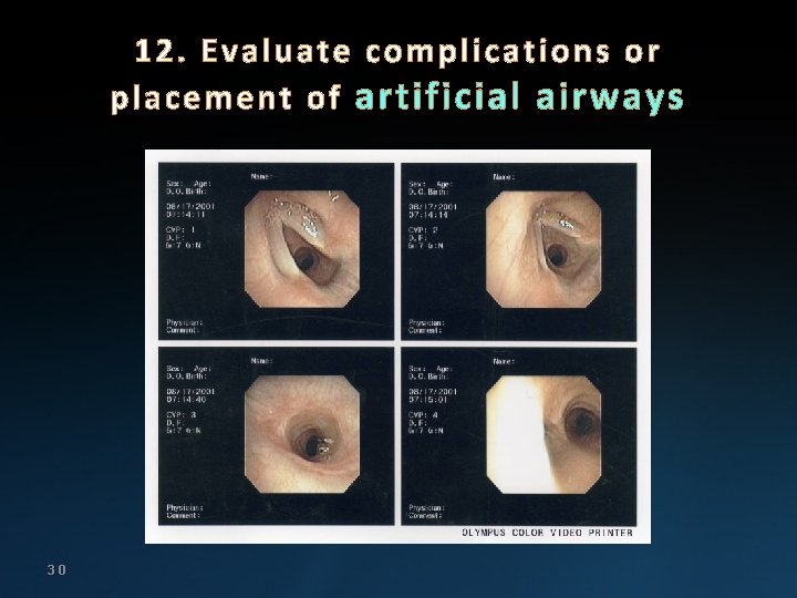 12. Evaluate complications or placement of artificial airways 30 