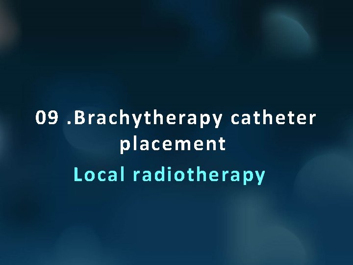 09. Brachytherapy catheter placement Local radiotherapy 