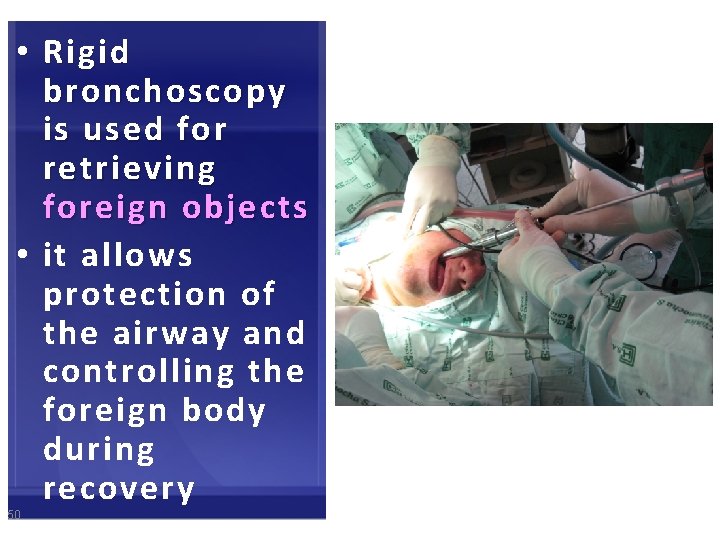  • Rigid bronchoscopy is used for retrieving foreign objects • it allows protection