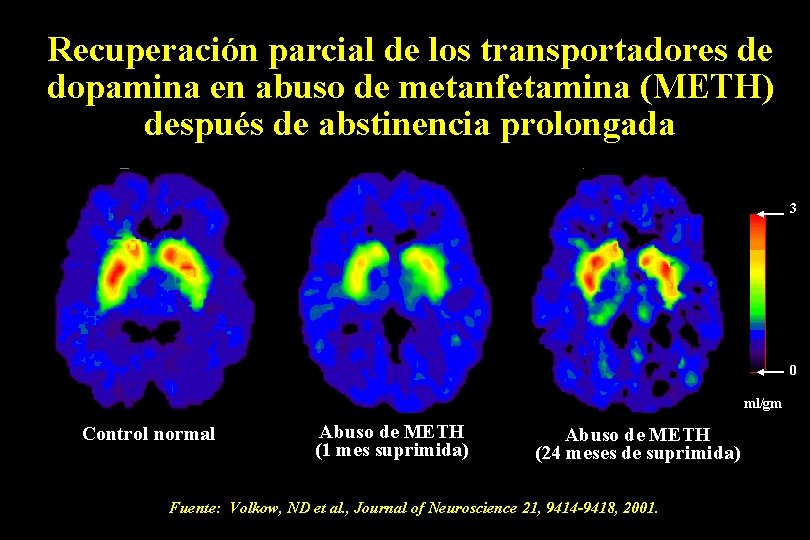 Recuperación parcial de los transportadores de dopamina en abuso de metanfetamina (METH) después de