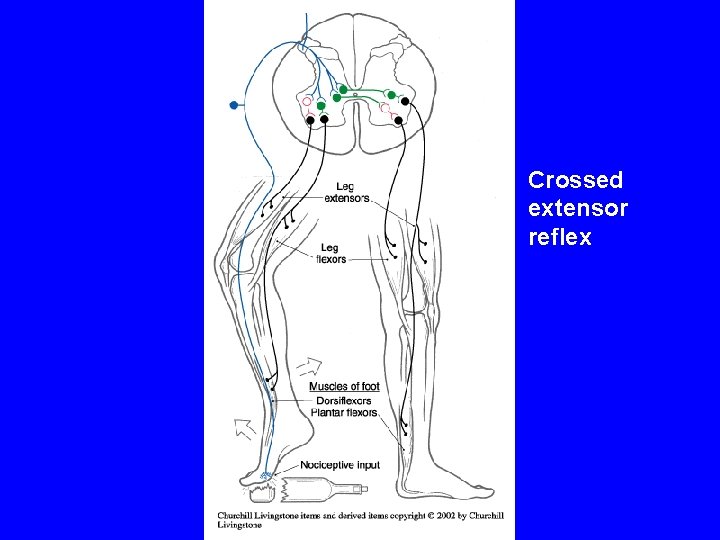 Crossed extensor reflex 