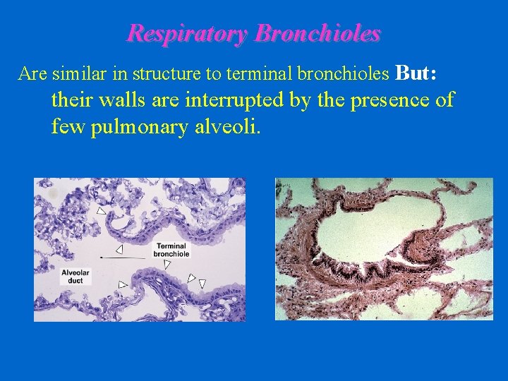 Respiratory Bronchioles Are similar in structure to terminal bronchioles But: their walls are interrupted