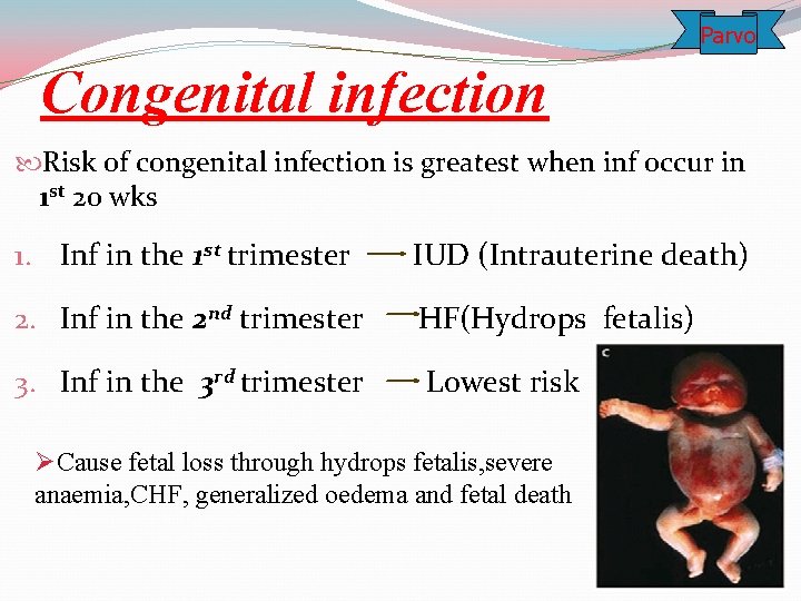Parvo Congenital infection Risk of congenital infection is greatest when inf occur in 1