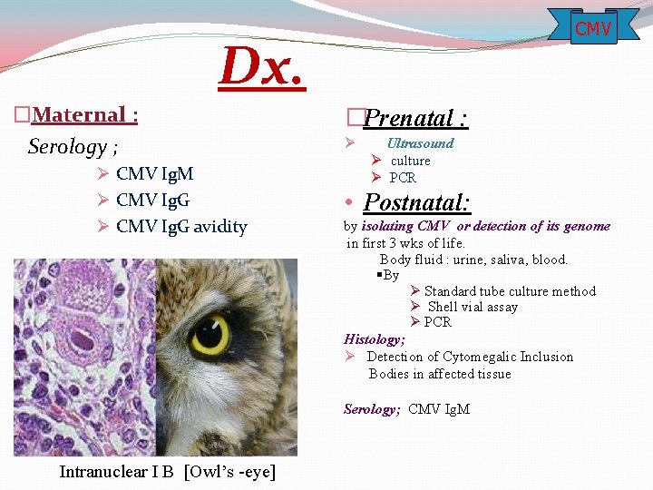 CMV Dx. �Maternal : Serology ; Ø CMV Ig. M Ø CMV Ig. G