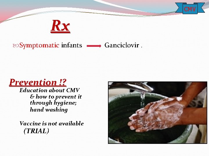CMV Rx Symptomatic infants Ganciclovir. Prevention !? Education about CMV & how to prevent