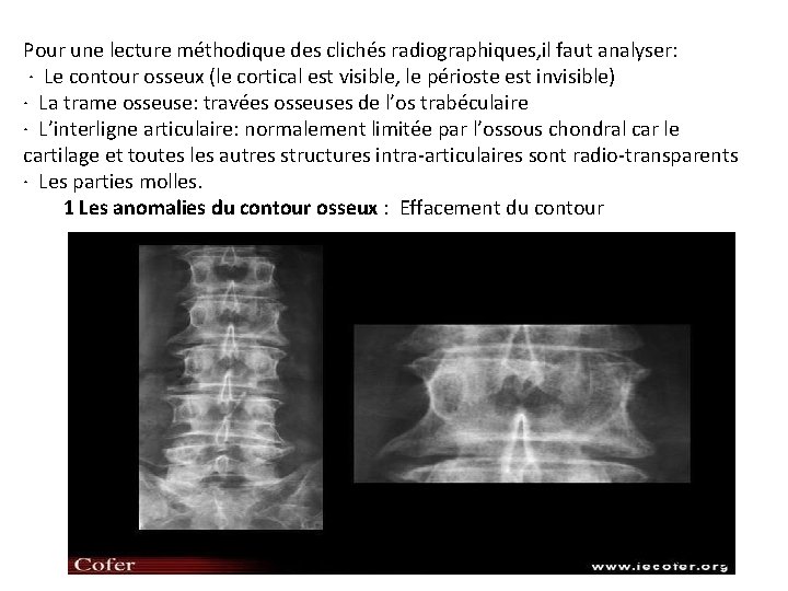 Pour une lecture méthodique des clichés radiographiques, il faut analyser: · Le contour osseux