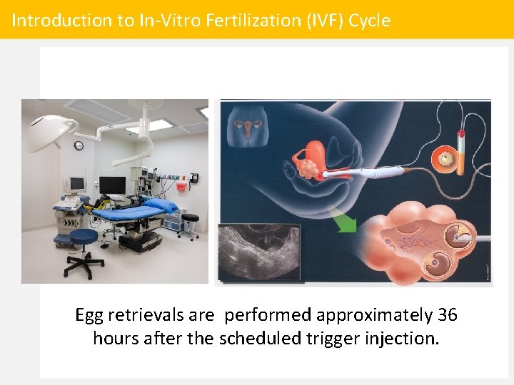 Introduction to In-Vitro Fertilization (IVF) Cycle Egg retrievals are performed approximately 36 hours after