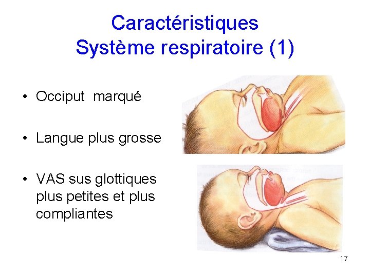 Caractéristiques Système respiratoire (1) • Occiput marqué • Langue plus grosse • VAS sus