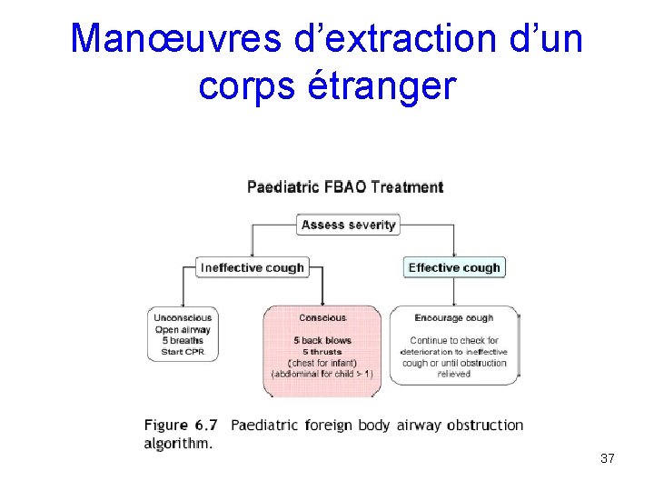 Manœuvres d’extraction d’un corps étranger 37 