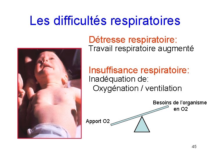 Les difficultés respiratoires Détresse respiratoire: Travail respiratoire augmenté Insuffisance respiratoire: Inadéquation de: Oxygénation /