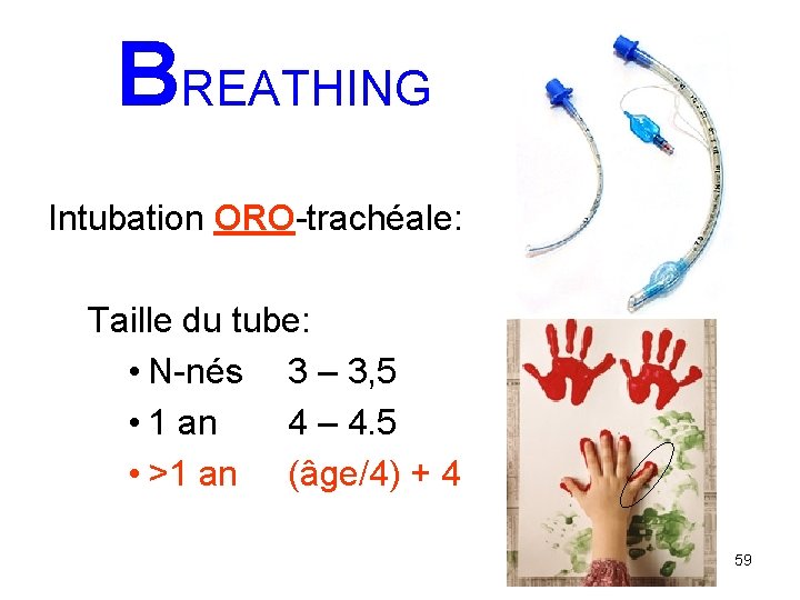 BREATHING Intubation ORO-trachéale: Taille du tube: • N-nés 3 – 3, 5 • 1