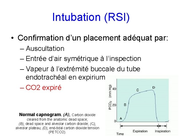 Intubation (RSI) • Confirmation d’un placement adéquat par: – Auscultation – Entrée d’air symétrique