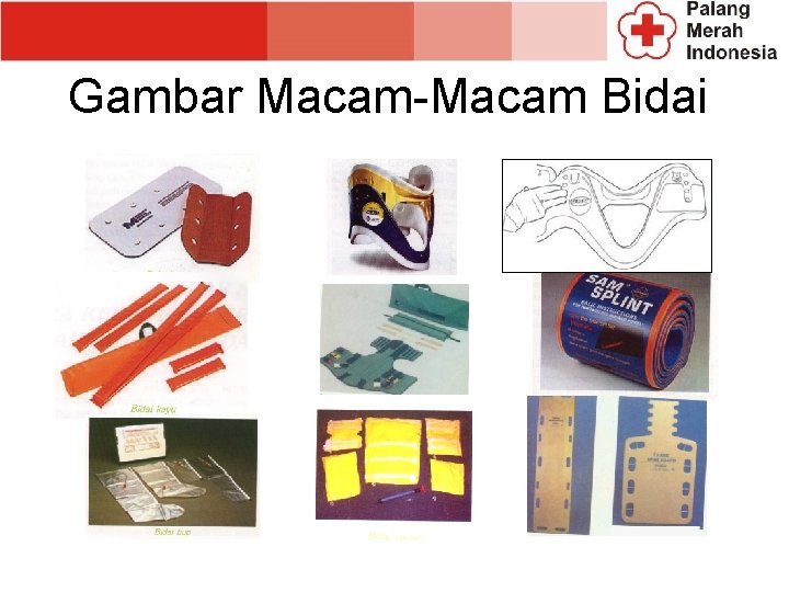 TRAUMA 2 Cedera Sistem Otot Rangka Macam Penyebabnya