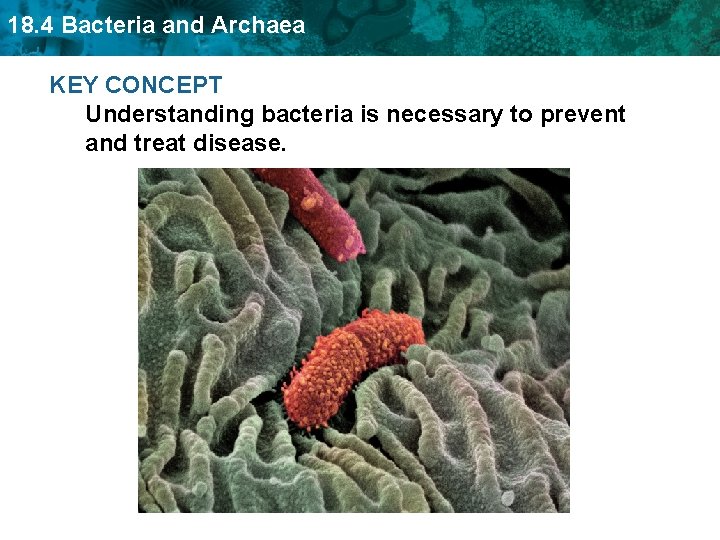 18. 4 Bacteria and Archaea KEY CONCEPT Understanding bacteria is necessary to prevent and