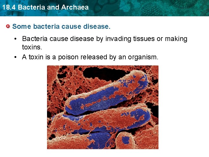 18. 4 Bacteria and Archaea Some bacteria cause disease. • Bacteria cause disease by