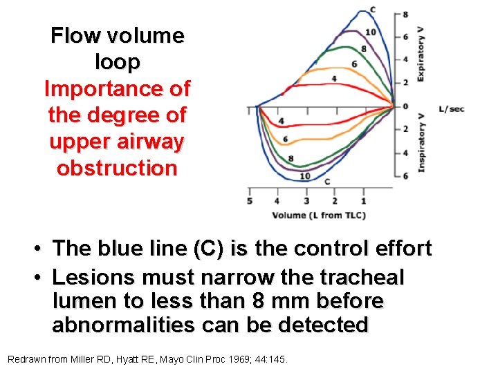 Flow volume loop Importance of the degree of upper airway obstruction • The blue