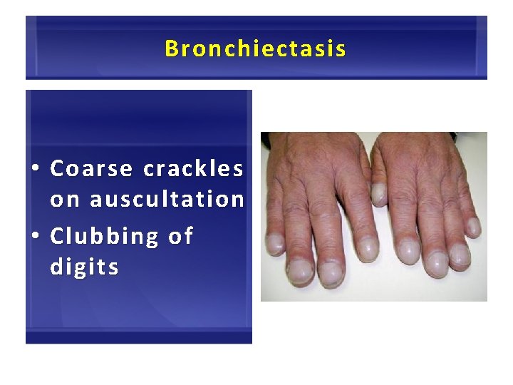 Bronchiectasis • Coarse crackles on auscultation • Clubbing of digits 47 