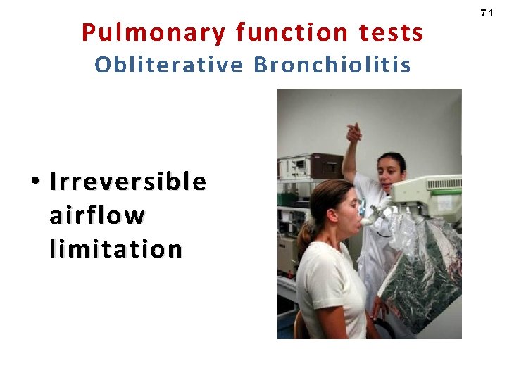 Pulmonary function tests Obliterative Bronchiolitis • Irreversible airflow limitation 71 