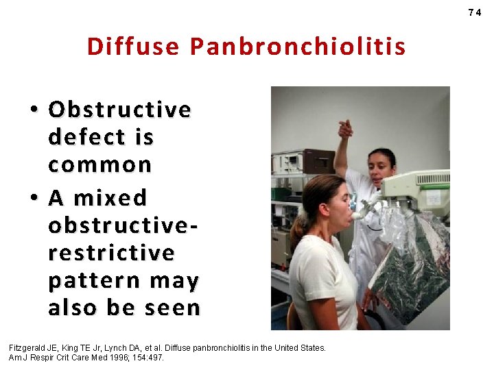 74 Diffuse Panbronchiolitis • Obstructive defect is common • A mixed obstructiverestrictive pattern may