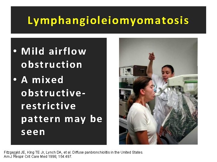 Lymphangioleiomyomatosis • Mild airflow obstruction • A mixed obstructiverestrictive pattern may be seen Fitzgerald