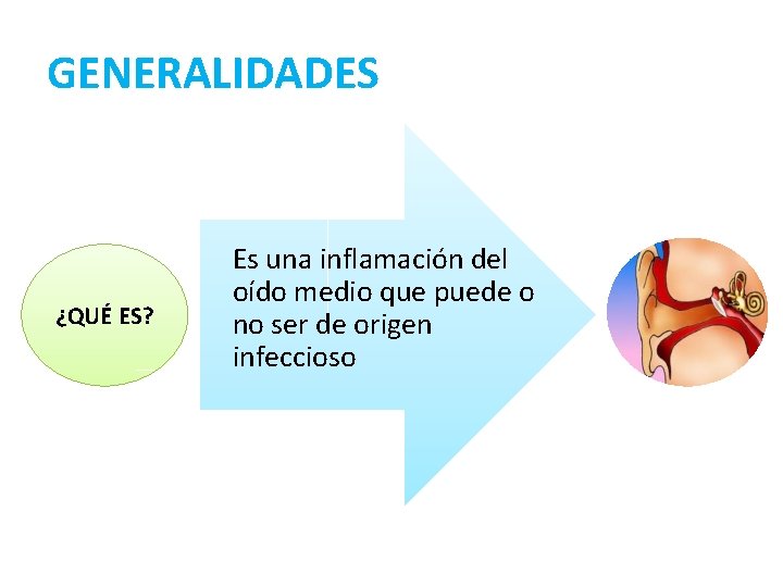GENERALIDADES ¿QUÉ ES? Es una inflamación del oído medio que puede o no ser
