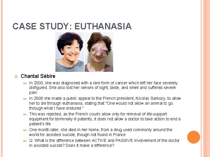 CASE STUDY: EUTHANASIA Chantal Sébire In 2000, she was diagnosed with a rare form