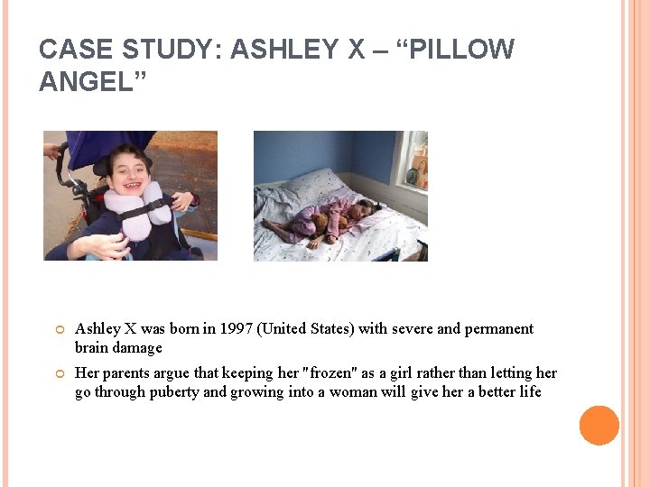 CASE STUDY: ASHLEY X – “PILLOW ANGEL” Ashley X was born in 1997 (United