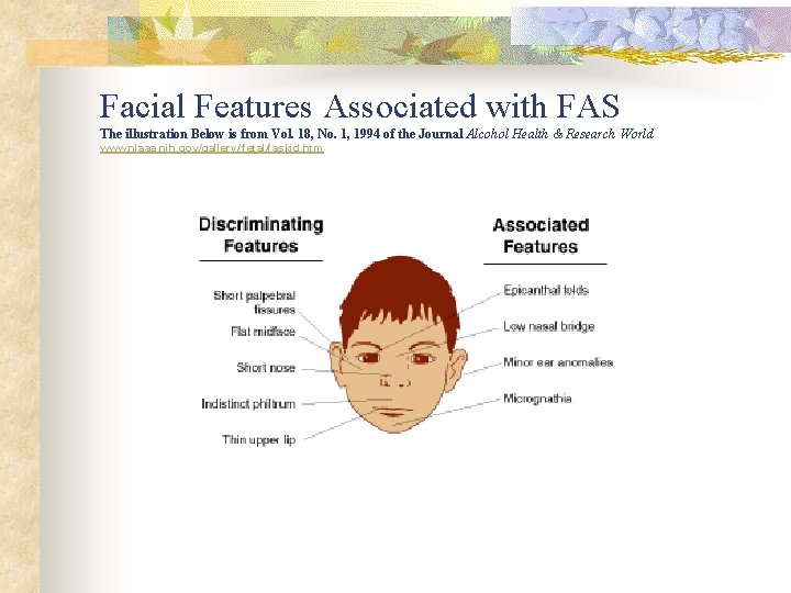 Facial Features Associated with FAS The illustration Below is from Vol. 18, No. 1,
