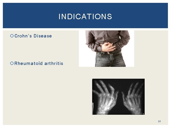 INDICATIONS Crohn’s Disease Rheumatoïd arthritis 18 