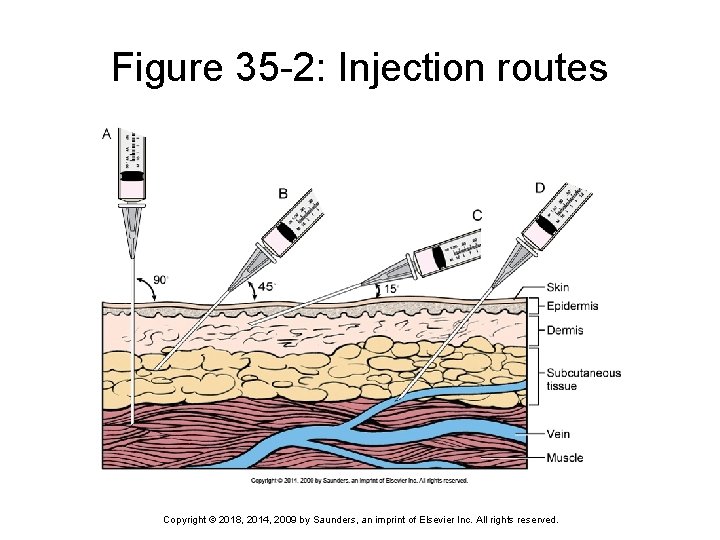 Figure 35 -2: Injection routes Copyright © 2018, 2014, 2009 by Saunders, an imprint