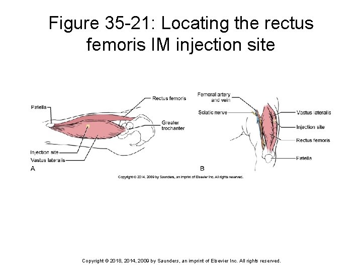 Figure 35 -21: Locating the rectus femoris IM injection site Copyright © 2018, 2014,