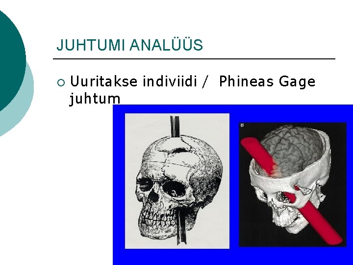 JUHTUMI ANALÜÜS ¡ Uuritakse indiviidi / Phineas Gage juhtum 