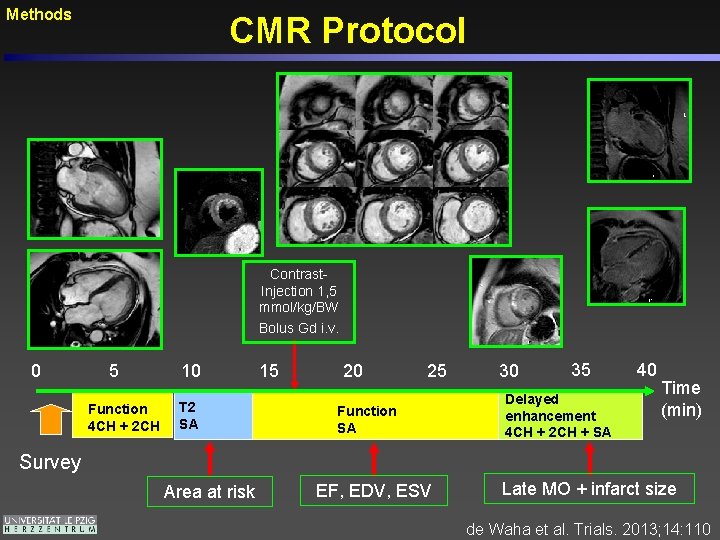 Methods CMR Protocol Contrast. Injection 1, 5 mmol/kg/BW Bolus Gd i. v. 0 5