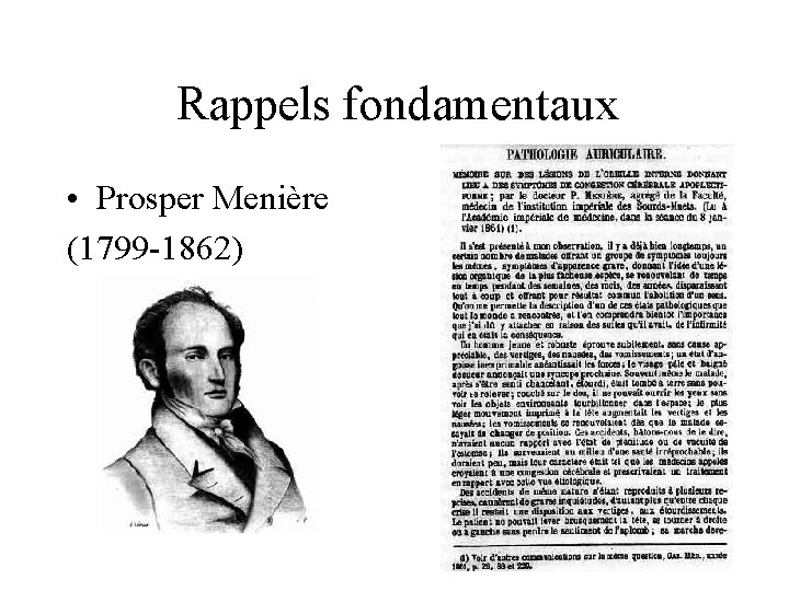 Rappels fondamentaux • Prosper Menière (1799 -1862) 