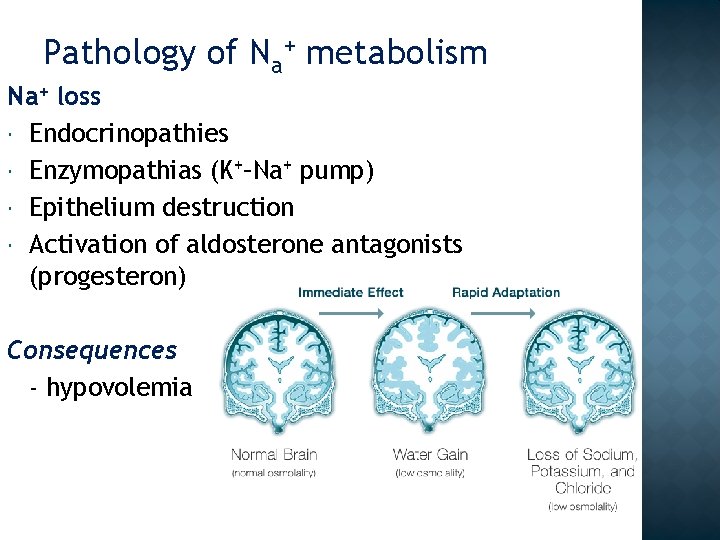 Pathology of Na+ metabolism Na+ loss Endocrinopathies Enzymopathias (K+–Na+ pump) Epithelium destruction Activation of